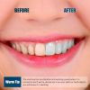 Teeth Cleaning Kit, MOCEMTRY Teeth Cleaning Kit for Home Dental Care for Tartar, Plaque, Tartar and Stains 4 Heads and 4 Modes for Kids Adult USB Rech
