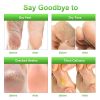 Foot exfoliating mask, suitable for dead skin and calluses, gentle foot care foot mask 2 pieces-Aloe